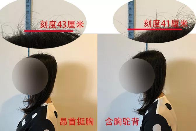 你可能也變得脖子前傾、含胸駝背了