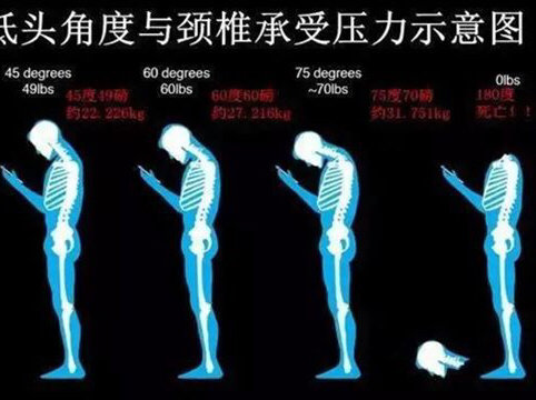 頸椎病、頸椎病、我用這些方法治頸椎