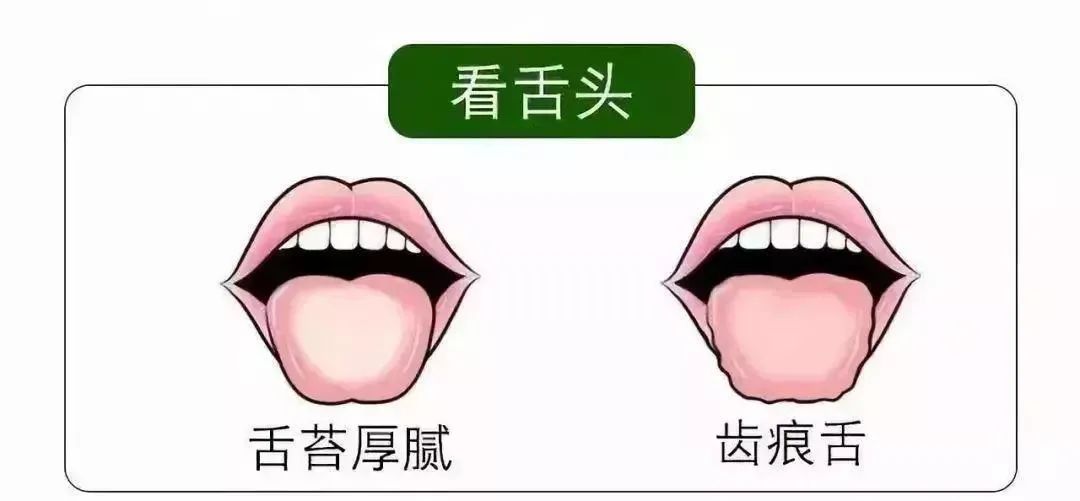 清明時(shí)節(jié)雨紛紛 疏通經(jīng)絡(luò)馬上給身體加分！